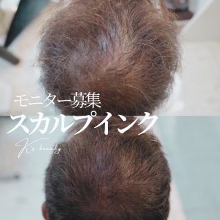 ＼今話題の頭皮タトゥー技法をいち早く体験／
【スカルプインクモニター様募集中❤️‍🔥】

いつもご愛顧いただきありがとうございます♡

今回はスカルプインクのモニター様募集のご案内です✨

＿＿スカルプインクとは🪶＿＿＿＿＿＿＿

麻酔なしでも比較的痛みを感じにくい頭皮タトゥー技法です。
スライディングテクニックや4Dテクニックを活用し、より自然な仕上がりを目指します。

スカルプインクオリジナルの特殊なインクを使用し、毛髪と同じサイズの美しいドットを描いていきます。
（回数や時間は範囲や皮膚の状態によって個人差があります。）

ダウンタイムがほとんどなく、当日からシャンプー可能な方もいます。

髪のボリュームが気になる方におすすめ✨
地肌の透け感を目立ちにくくするだけでなく、フェイスラインにグラデーションを入れることで、自然に小顔の印象へ。

スカルプタトゥー専用オートマシンと、特許取得済みの特殊形状のニードルを使用。
マシン×テクニック×インクの組み合わせで、より自然な仕上がりを目指しています✨

＿＿＿＿＿＿＿＿＿＿＿＿＿＿＿＿＿＿＿

施術後、すぐに変化を感じる方もいらっしゃいます✨

髪のボリュームが気になる方や、分け目・生え際の印象をナチュラルに整えたい方、
この機会にぜひお試しください🌸

＿＿＿＿＿＿＿＿＿＿＿＿＿＿＿＿＿＿＿

【📹 動画モニター募集概要】

 通常料金：1ショット1.1円  3万ショット〜/回

 モニター料金：モニター様は特別価格でご案内いたします。ぜひお問い合わせください💌

お問い合わせの際には下記の内容をご記入の上、ご連絡ください。
①氏名
②年齢
③電話番号
④ご希望日もしくは曜日と時間帯

✅ 男女可能
✅ ご新規様限定（メンテナンスの方などは対象外）
✅ 施術前後の写真撮影にご協力いただける方
✅ Google口コミ/SNS掲載可能な方（頭部施術箇所）
✅ 他キャンペーンとの併用不可

⚠️ 人数限定のため、定員に達し次第終了いたします。

＿＿＿＿＿＿＿＿＿＿＿＿＿＿＿＿＿＿＿

#スカルプケア #分け目 #薄毛 #ヘアタトゥー #髪の悩み
#頭皮タトゥー #沖縄 #イメージチェンジ #美容タトゥー
#スカルプインク #頭皮カバー #つむじ #ヘアライン #生え際
#頭皮ケア #女性薄毛 #男性薄毛 #つむじ割れ